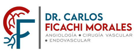 Angiología, Cirugía Vascular y Endovascular en
Puebla - Dr. Carlos Sebastián Ficachi Morales