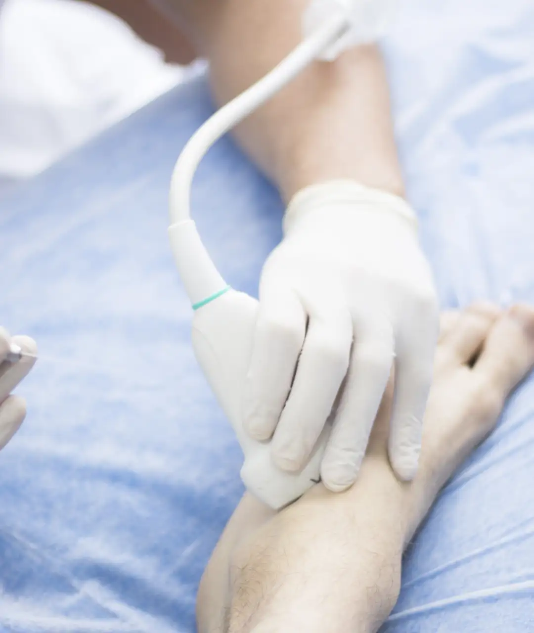 Diagnóstico Vascular No Invasivo en Puebla