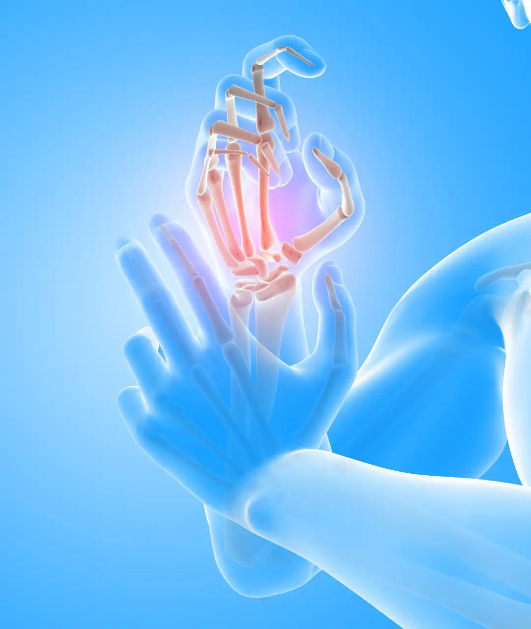 Escleroterapia en Puebla