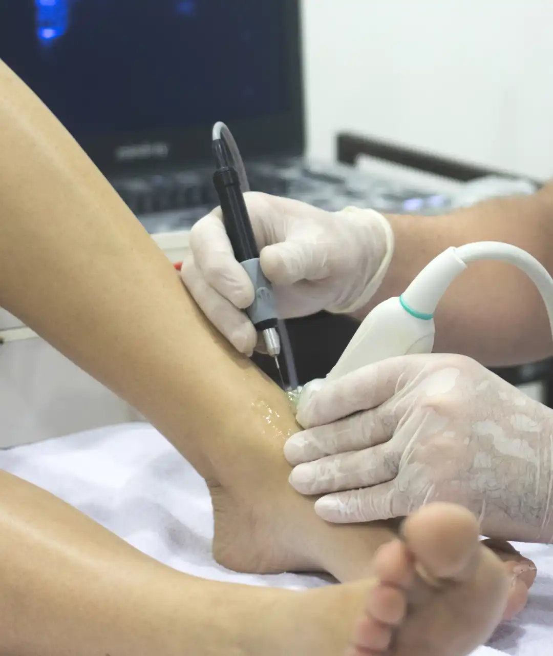Rehabilitación Vascular en Puebla