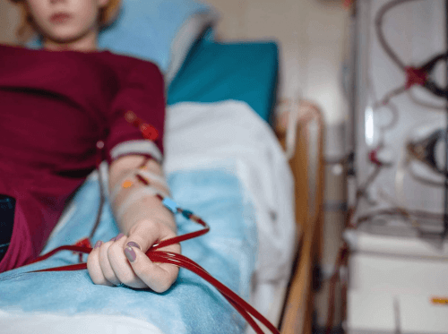 Construcción de Fístula para Hemodiálisis y Accesos Vasculares Centrales