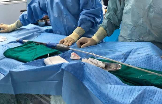 Intervenciones Endovasculares para Aneurisma de Aorta Abdominal y Torácica